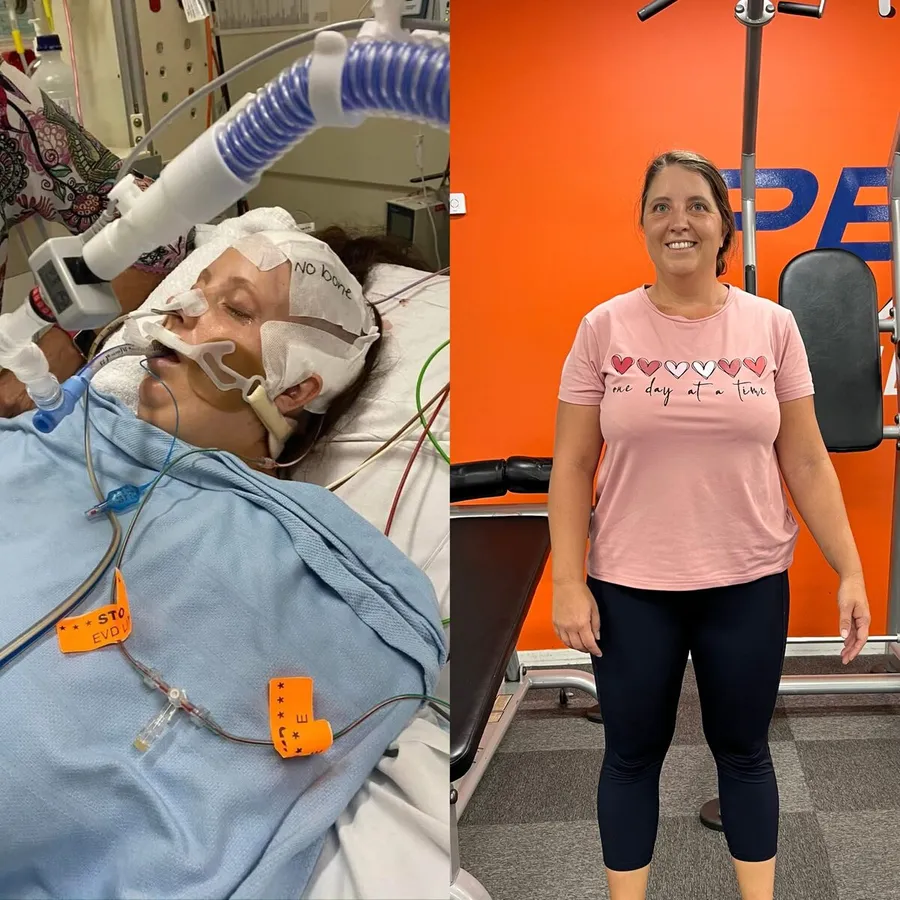 Amy in hospital on life support, and Amy today standing in front of the Peak Fitness wall